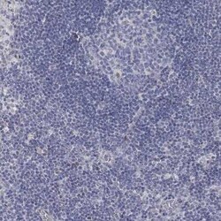 ANO7 Rabbit anti-Human, Polyclonal, Novus Biologicals 100 &mu;g; Unconjugated:Antibodies,