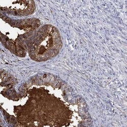 ANO7 Rabbit anti-Human, Polyclonal, Novus Biologicals 100 &mu;g; Unconjugated:Antibodies,