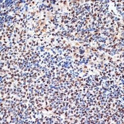 ANP32B Rabbit anti-Human, Mouse, Rat, Clone: 4A8E5, Novus Biologicals:Antibodies:Primary
