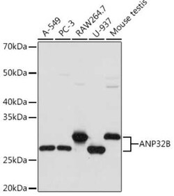 ANP32B Rabbit anti-Human, Mouse, Rat, Clone: 4A8E5, Novus Biologicals:Antibodies:Primary