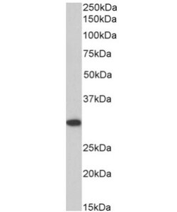 ANP32B Antibody, Novus Biologicals 0.1mg; Unlabeled:Antibodies, Polyclonal