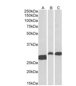 ANP32B Antibody, Novus Biologicals 0.1mg; Unlabeled:Antibodies, Polyclonal