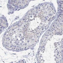 ANUBL1 Rabbit anti-Human, Polyclonal, Novus Biologicals 100 &mu;g; Unconjugated:Antibodies,