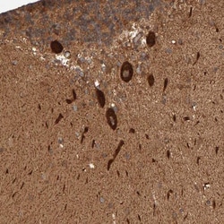 AP1GBP1 Antibody, Novus Biologicals:Antibodies:Primary Antibodies