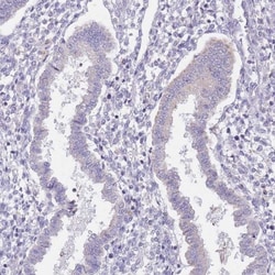 AP1S2 Antibody, Novus Biologicals 0.1mL; Unlabeled:Antibodies, Polyclonal