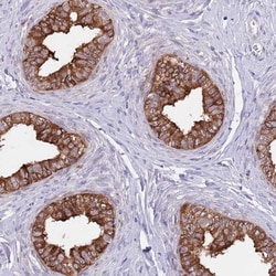 AP1S2 Antibody, Novus Biologicals 0.1mL; Unlabeled:Antibodies, Polyclonal