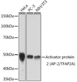 AP2 alpha Rabbit anti-Human, Mouse, Clone: 8I8E4, Novus Biologicals 20