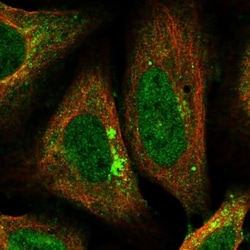 AP2 alpha Antibody, Novus Biologicals:Antibodies:Primary Antibodies