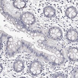 AP2 alpha Antibody, Novus Biologicals:Antibodies:Primary Antibodies