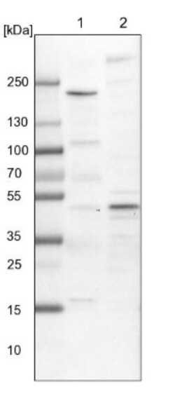 AP2 alpha Antibody, Novus Biologicals:Antibodies:Primary Antibodies