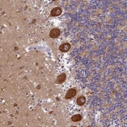 AP3B2 Antibody, Novus Biologicals 0.1mL; Unlabeled:Antibodies, Polyclonal