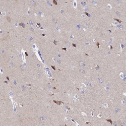 AP3B2 Antibody, Novus Biologicals 0.1mL; Unlabeled:Antibodies, Polyclonal