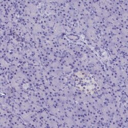 AP3B2 Antibody, Novus Biologicals 0.1mL; Unlabeled:Antibodies, Polyclonal