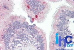 AP3M1 Antibody, Novus Biologicals 0.025mg; Unlabeled:Antibodies, Polyclonal