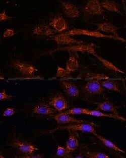 AP3S2 Rabbit anti-Human, Mouse, Rat, Polyclonal, Novus Biologicals 20 &mu;g | Buy Online | Novus Biologicals | Fisher Scientific