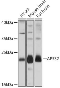 AP3S2 Rabbit anti-Human, Mouse, Rat, Polyclonal, Novus Biologicals 20 &mu;g | Buy Online | Novus Biologicals | Fisher Scientific