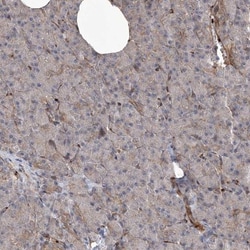 APAF-1 Antibody, Novus Biologicals:Antibodies:Primary Antibodies