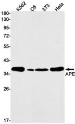 APE Rabbit anti-Human, Mouse, Rat, Clone: S07-5A9, Novus Biologicals 25
