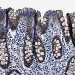 APEG1 Antibody, Novus Biologicals:Antibodies:Primary Antibodies