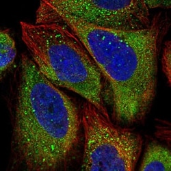 APEH Antibody, Novus Biologicals:Antibodies:Primary Antibodies
