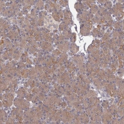 APEH Antibody, Novus Biologicals:Antibodies:Primary Antibodies