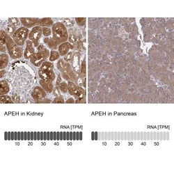 APEH Antibody, Novus Biologicals:Antibodies:Primary Antibodies