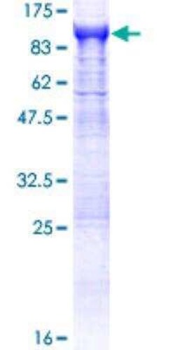 Novus Biologicals Recombinant Human APEH GST (N-Term) Protein 10 &mu;g | Buy Online | Novus Biologicals&trade; | Fisher Scientific