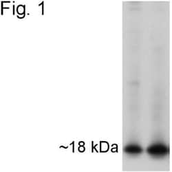 APH1A Antibody, Novus Biologicals 0.1mg; Unlabeled:Antibodies, Polyclonal