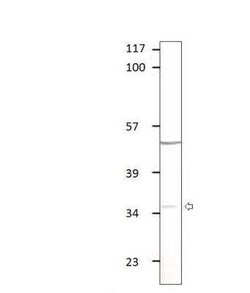 APH1B Antibody, Novus Biologicals 100 &mu;g | Buy Online | Novus Biologicals | Fisher Scientific