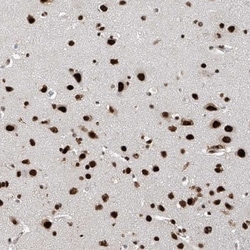 APLF Antibody, Novus Biologicals 25 &mu;L, Unlabeled:Antibodies, Polyclonal
