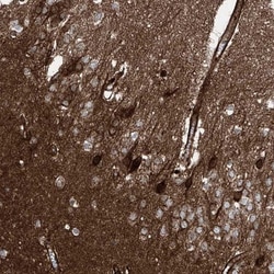 APLP-1 Antibody, Novus Biologicals 25 &mu;L; Unlabeled:Antibodies, Polyclonal