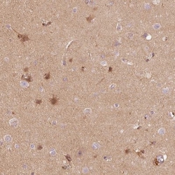 APLP-1 Antibody, Novus Biologicals 25 &mu;L; Unlabeled:Antibodies, Polyclonal