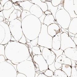 APM2 Antibody, Novus Biologicals:Antibodies:Primary Antibodies