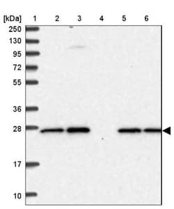 APOA1BP Antibody, Novus Biologicals 25 &mu;L | Buy Online | Novus Biologicals | Fisher Scientific