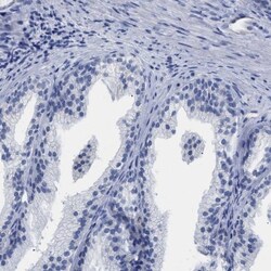 APOBEC2 Antibody, Novus Biologicals:Antibodies:Primary Antibodies