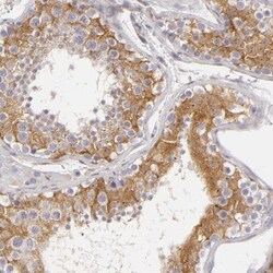 APOBEC3G Antibody, Novus Biologicals 0.1mL; Unlabeled:Antibodies, Polyclonal