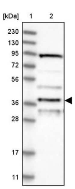 APOL6 Antibody, Novus Biologicals 0.1mL; Unlabeled:Antibodies, Polyclonal