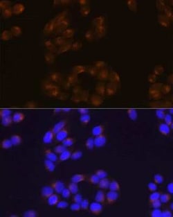 APP Rabbit anti-Human, Mouse, Rat, Clone: 3A8S2, Novus Biologicals:Antibodies:Primary