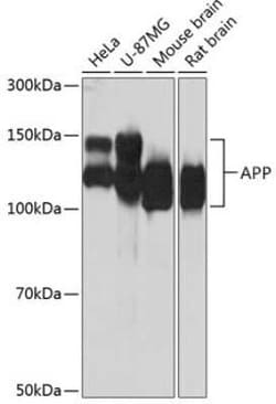 APP Rabbit anti-Human, Mouse, Rat, Clone: 3A8S2, Novus Biologicals:Antibodies:Primary