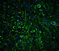 APP Antibody, Novus Biologicals 0.1 mg | Buy Online | Novus Biologicals | Fisher Scientific