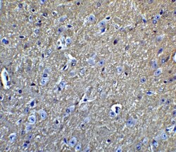 APP Antibody, Novus Biologicals 0.1 mg | Buy Online | Novus Biologicals | Fisher Scientific