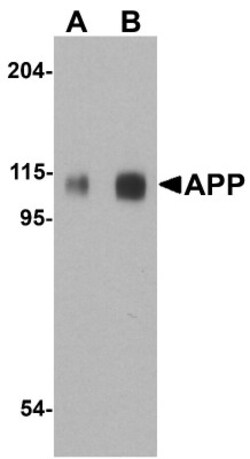 APP Antibody, Novus Biologicals 0.1 mg | Buy Online | Novus Biologicals | Fisher Scientific
