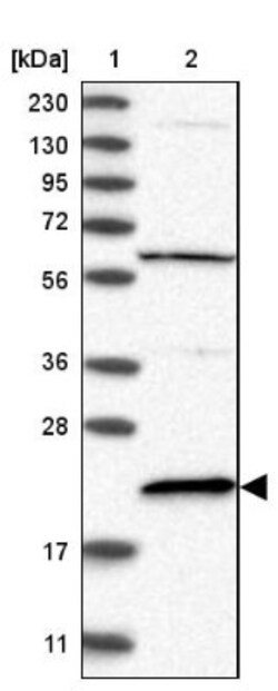 APRT Antibody, Novus Biologicals 0.1mL; Unlabeled:Antibodies, Polyclonal