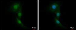 ARA54 Antibody, Novus Biologicals 0.1mL; Unlabeled:Antibodies, Polyclonal