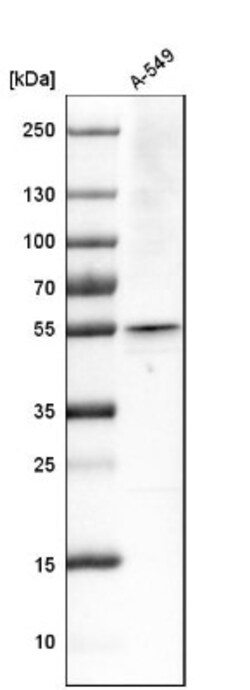 ARA54 Antibody, Novus Biologicals 0.1mL; Unlabeled:Antibodies, Polyclonal