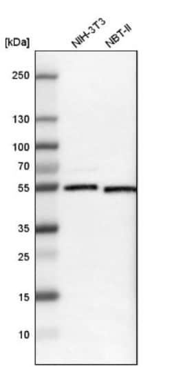 ARA54 Antibody, Novus Biologicals 0.1mL; Unlabeled:Antibodies, Polyclonal