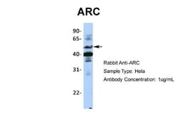 ARC/ARG3.1 Antibody, Novus Biologicals 0.05mg; Unlabeled:Antibodies, Polyclonal