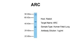 ARC/ARG3.1 Antibody, Novus Biologicals 0.05mg; Unlabeled:Antibodies, Polyclonal