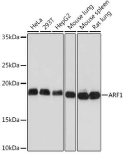 ARF1 Rabbit anti-Human, Mouse, Rat, Clone: 0C5B3, Novus Biologicals 20 &mu;g | Buy Online | Novus Biologicals | Fisher Scientific