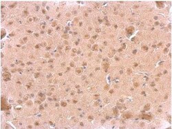 ARF3 Antibody, Novus Biologicals 100 &mu;L | Buy Online | Novus Biologicals | Fisher Scientific